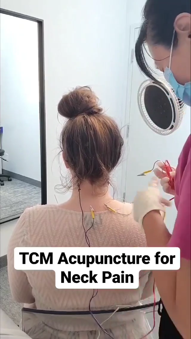 TCM acupuncture Orillia Downtown Cindy