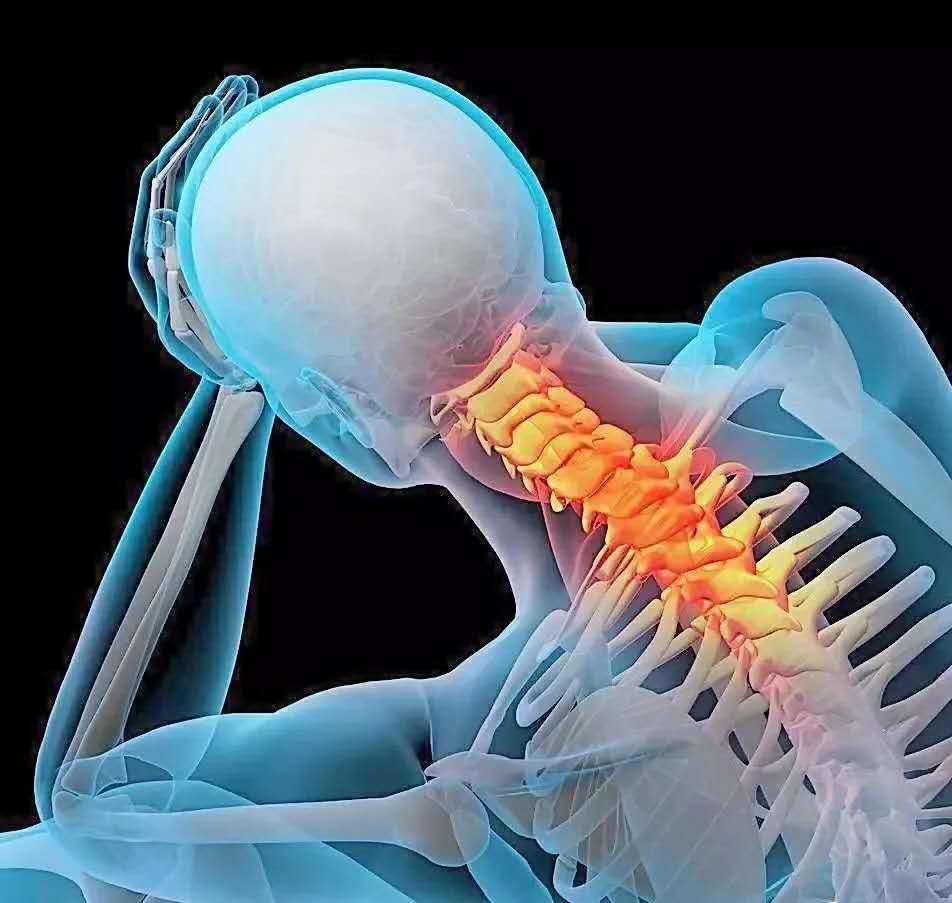 acupucture Orillia Neck pain