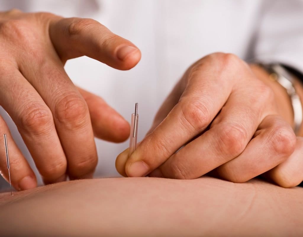 Acupuncture Orillia IVR & IUI