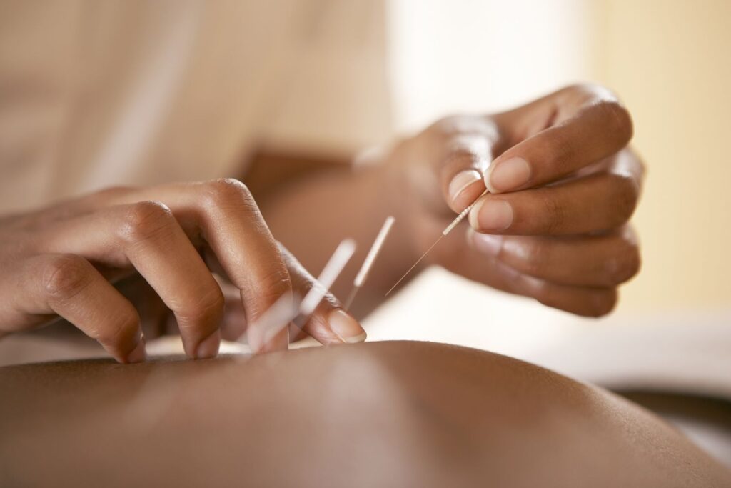 Acupuncture Orillia fertility