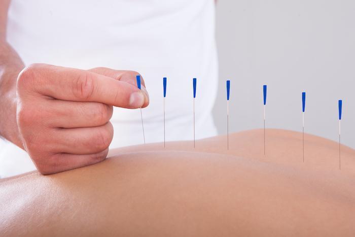 Acupuncture Orillia Acid Reflux