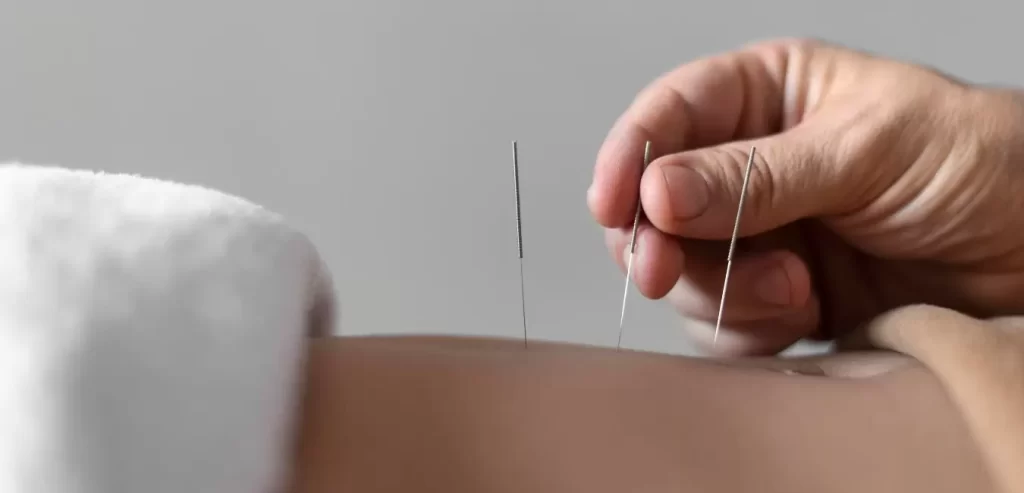 Acupuncture Orillia IVF & IUI 
