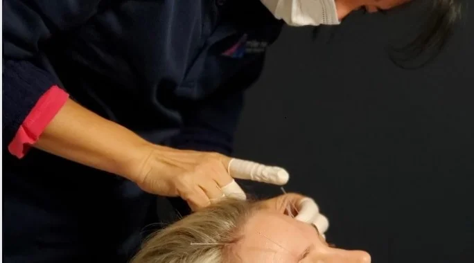 Cindy TCM Acupuncture Orillia cosmetics
